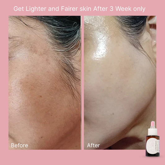 The Fairy: Skin Whitening
